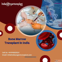 Best Bone Marrow Transplant Doctor in India