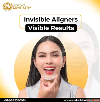 Aligners in Gurgaon - World of Dentistry for Clear Confident Smiles