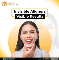 Aligners in Gurgaon - World of Dentistry for Clear Confident...