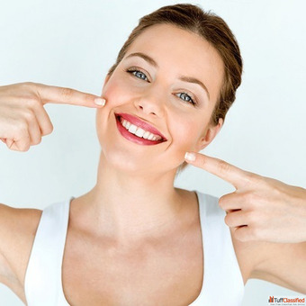 Dental Veneers in Dubai