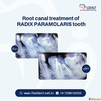 Top Oral Surgeons in Belathur Safe Hands Beautiful Results