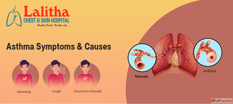 Asthma Explained Types Symptoms Causes Management Tips