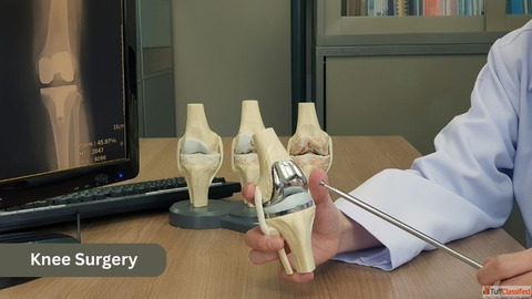 Get advanced knee surgery in India with expert orthopedic surgeons affordable care.