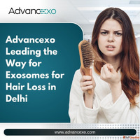 Advancexo Leading the Way for Exosomes for Hair Loss in Delh...