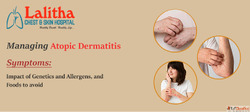 Managing Atopic Dermatitis Causes Genetics Foods to Avoid