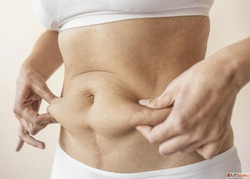 Looking for Expert Tummy Tuck Doctors in Thane Trust Laser C...