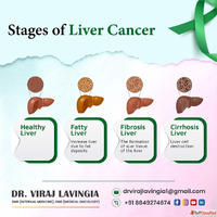 Leading Specialist for Liver Cancer Treatment in India