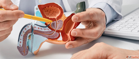 Best Varicocele Treatment in Bangalore