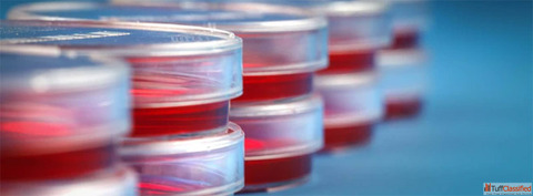 Immortalized Cell Lines Advancing Cancer Research