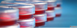 Immortalized Cell Lines Advancing Cancer Research