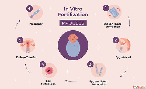 IVF Treatment In Delhi - Dr Rhythm Gupta
