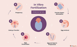 IVF Treatment In Delhi - Dr Rhythm Gupta