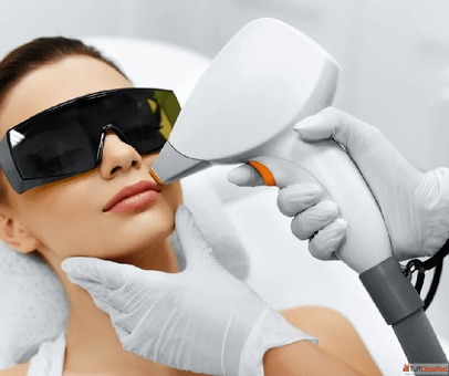 Safe and Effective Laser Hair Removal in Coimbatore at Dermavue
