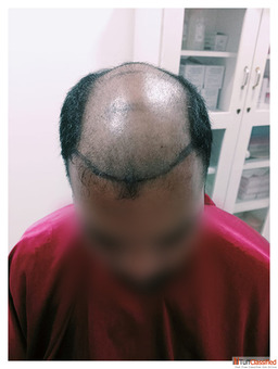 Visit Dermavue - The Leading Hair Clinic in Thrissur