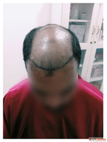Visit Dermavue - The Leading Hair Clinic in Thrissur