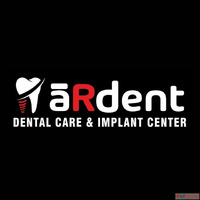 Full Mouth Dental Implants Treatment