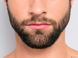Beard Transplant in Lucknow - Get a Perfect Beard Beard Tran...
