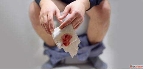 Trusted Homeopathy Doctor for Piles in Noida