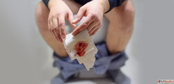 Trusted Homeopathy Doctor for Piles in Noida