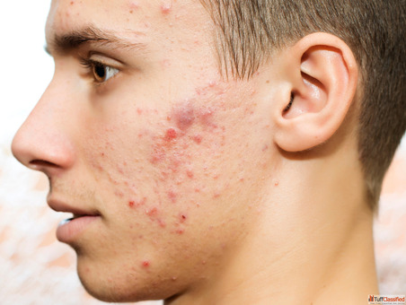 Top-Rated Homeopathy Doctor for Skin Problems in Noida