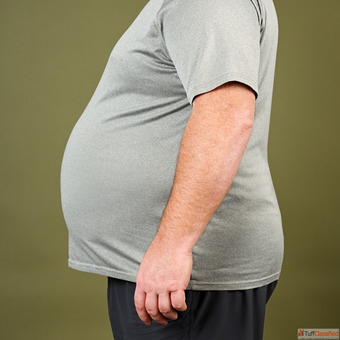 Best Obesity Surgeon in India Safe Bariatric Care