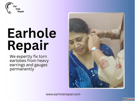Affordable Ear Piercing Hole Repair in Gurgaon Expert Surgeons