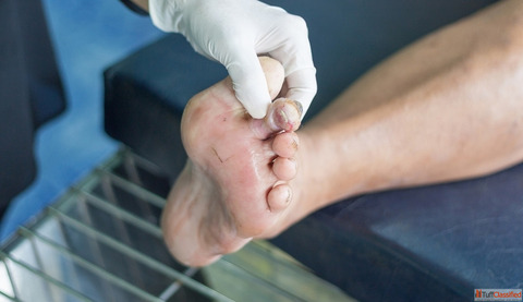 Dr. Dharav Kheradia - Skilled Diabetic Foot Surgeon in Mumbai