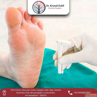 Dr. Krunal Gohil - Trusted for Best Gangrene Treatment in Ahmedabad India