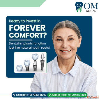 Best Dental Implant Clinic In Jubilee Hills Om Dental