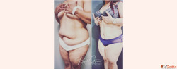 How Abdominoplasty Helps Flatten Your Tummy