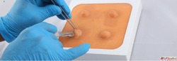 Cyst Abscess Removal Trainer for Hands-On Learning