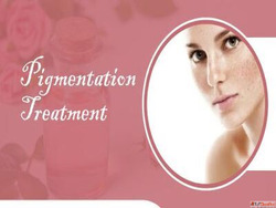 Pigmentation Treatment in Mumbai - Advanced Care at Gloss Cl...