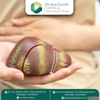 Best Liver Cancer Treatment in Ahmedabad India - Trusted Surgeon
