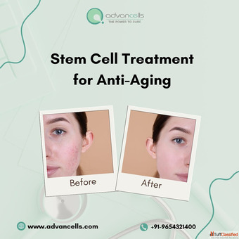Regenerative Medicine for Anti-Aging Harnessing the Stem Cell Potential