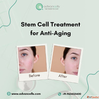 Regenerative Medicine for Anti-Aging Harnessing the Stem Cel...