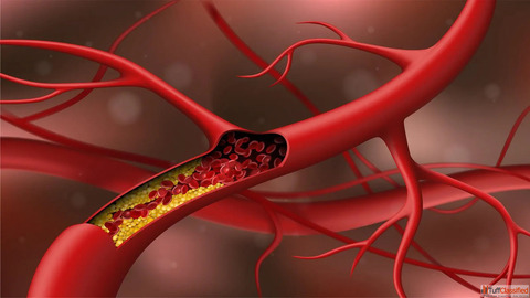 Balance Your Cholesterol Levels with Homeopathic Medicine