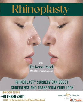 Affordable Rhinoplasty in Ahmedabad at Phoenix Cosmetic Centre