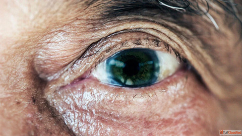 Stem Cell Treatment For Eyes in India