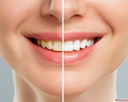 Best Dental Hospital in Manikonda Hyderabad Shantha Dental