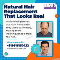 Hair Fixing Zone Professional Hair Patches Services Bangalor...