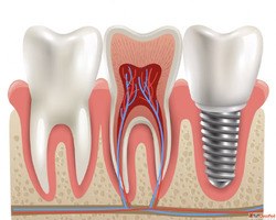 Best Dental Clinic in Vijayawada - Andhra Dental