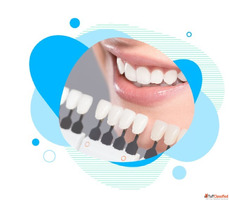 Best Dental Clinic in Delhi for Complete Dental Health