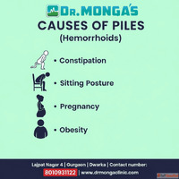 External Piles Treatment Without Surgery