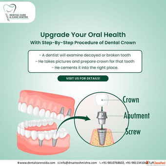 Healthy Smiles Begin Here - Dentist in Noida Sector 79
