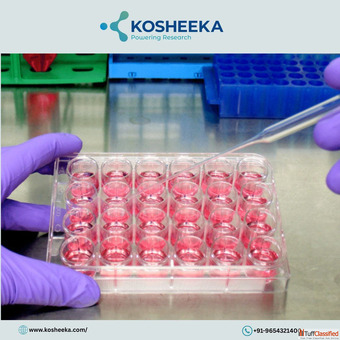 Custom-Specific Primary Cell Cultures Your Way to Precision