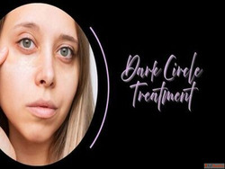 Effective Dark Circle Treatment in Mumbai - Gloss Clinic