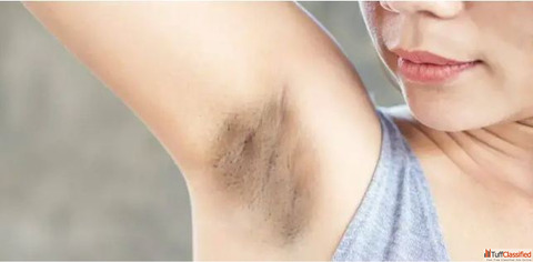 Laser Treatment for Dark Underarms