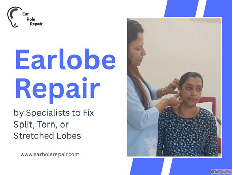 Ear Piercing Hole Repair in Mumbai Quick Affordable Treatment