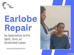 Ear Piercing Hole Repair in Mumbai Quick Affordable Treatmen...