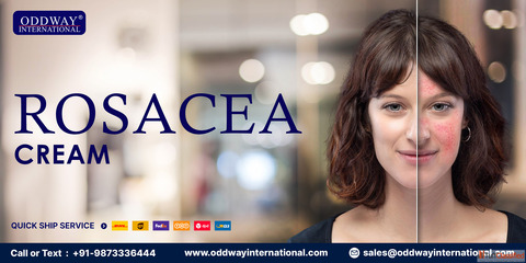 Best Rosacea Cream for Sensitive Skin - Oddway International